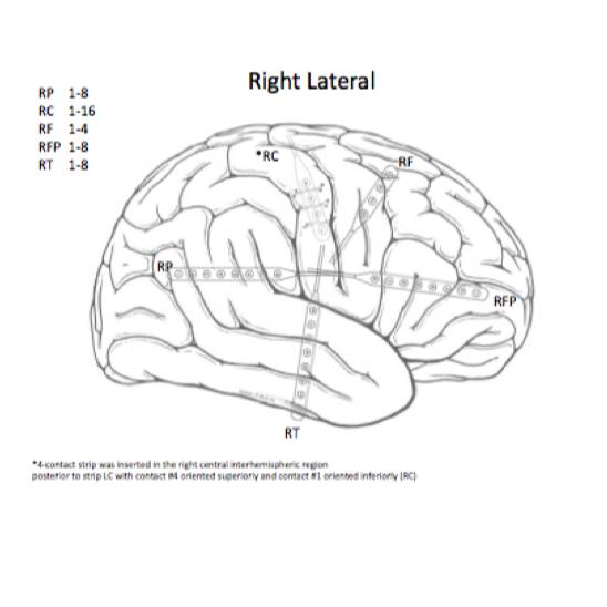 Dataset Banner Image