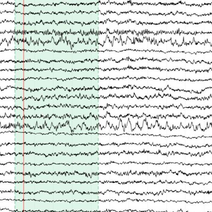 Dataset Banner Image